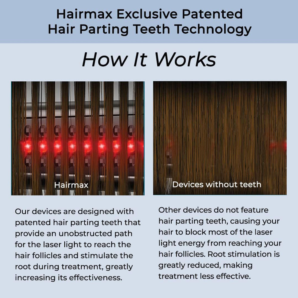 HairMax Ultima 12 Classic LaserComb packaging box ready-to-use at home.