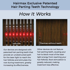 HairMax Ultima 12 Classic LaserComb packaging box ready-to-use at home.