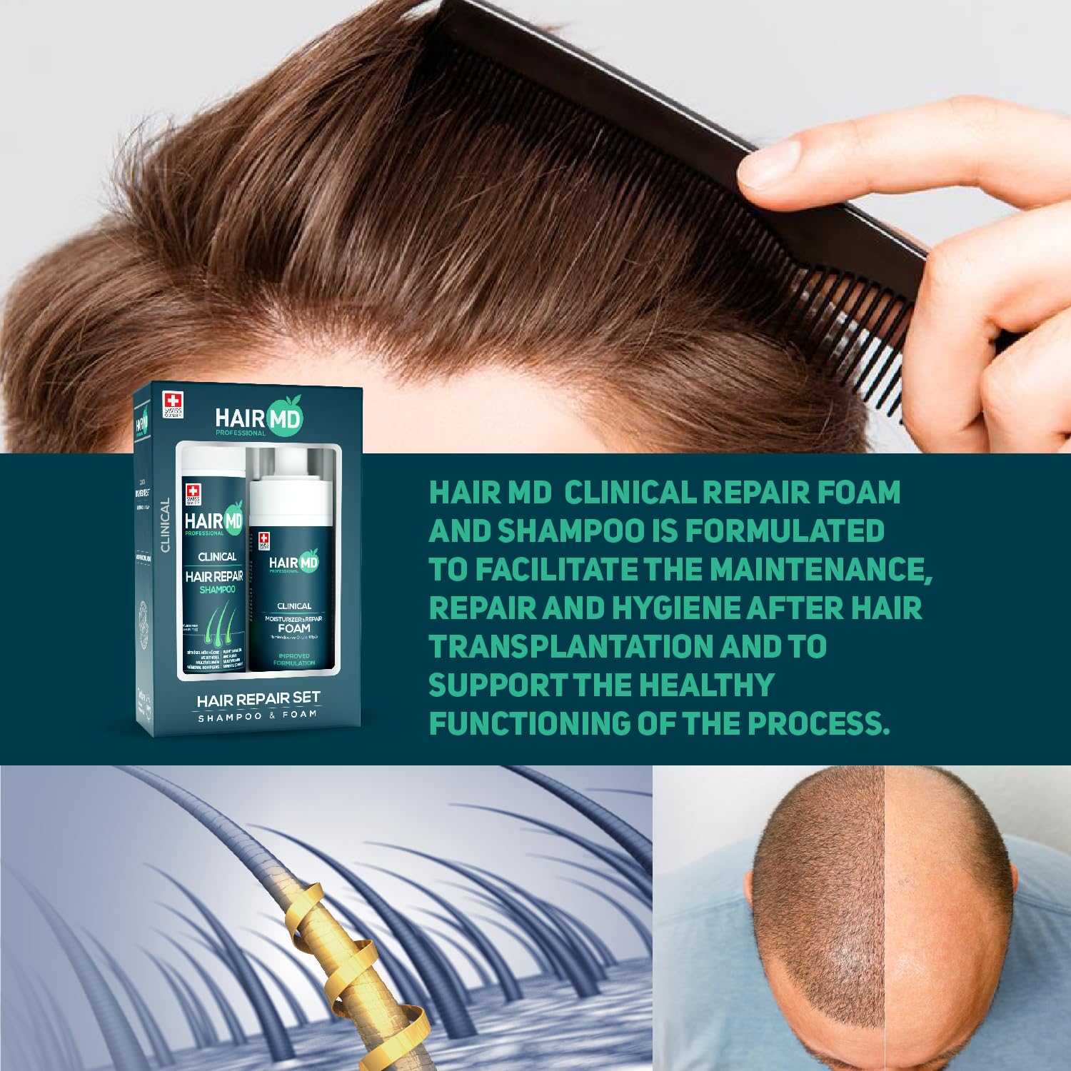 HairMD transplant hair repair set ingredients panel features saw palmetto and amino acids