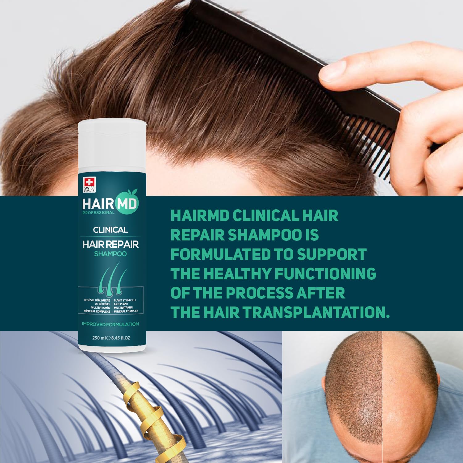 HairMD Transplant Repair Shampoo bottle on bathroom shelf ready for daily use.