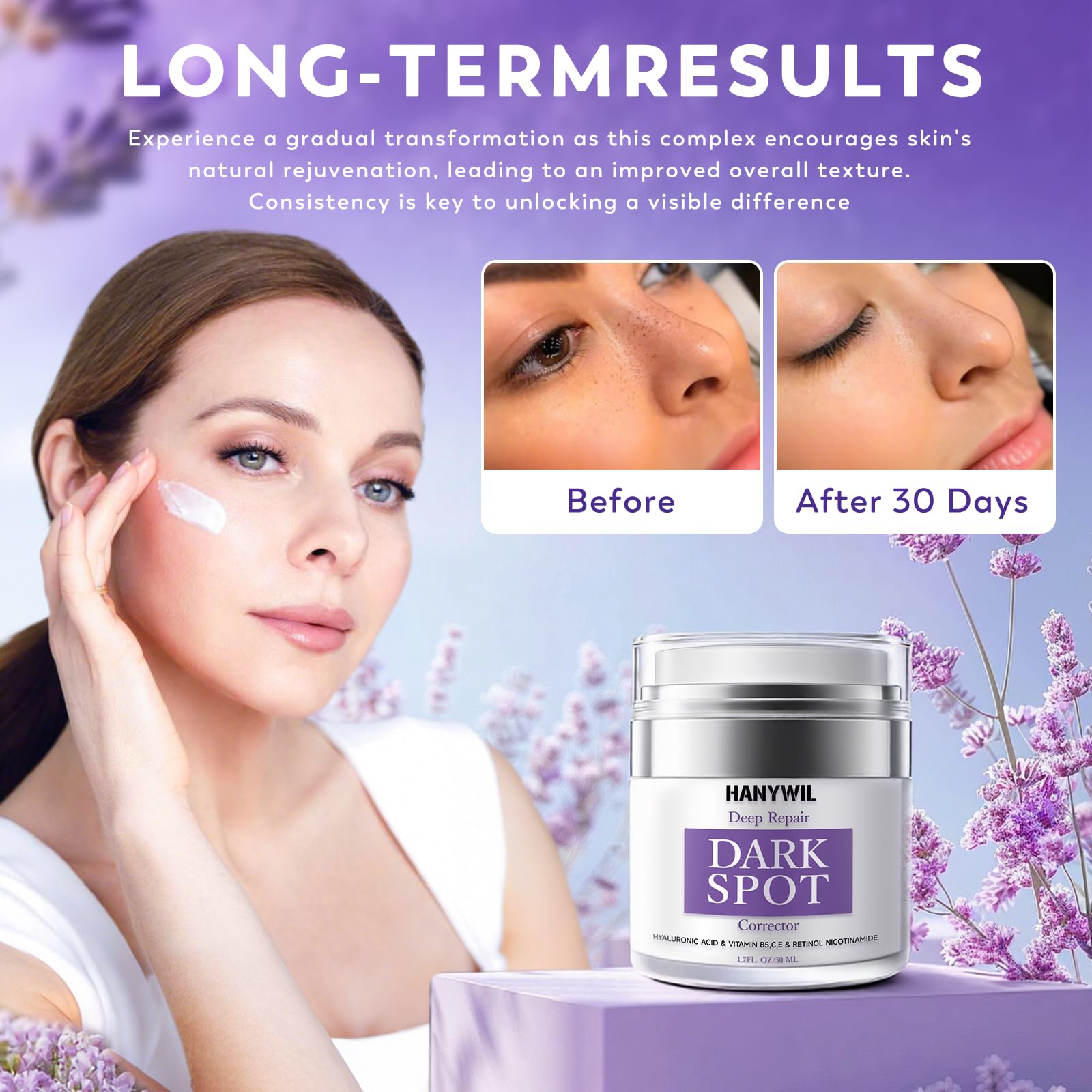 HANYWIL dark spot remover body cream jar targets discoloration for smoother skin.