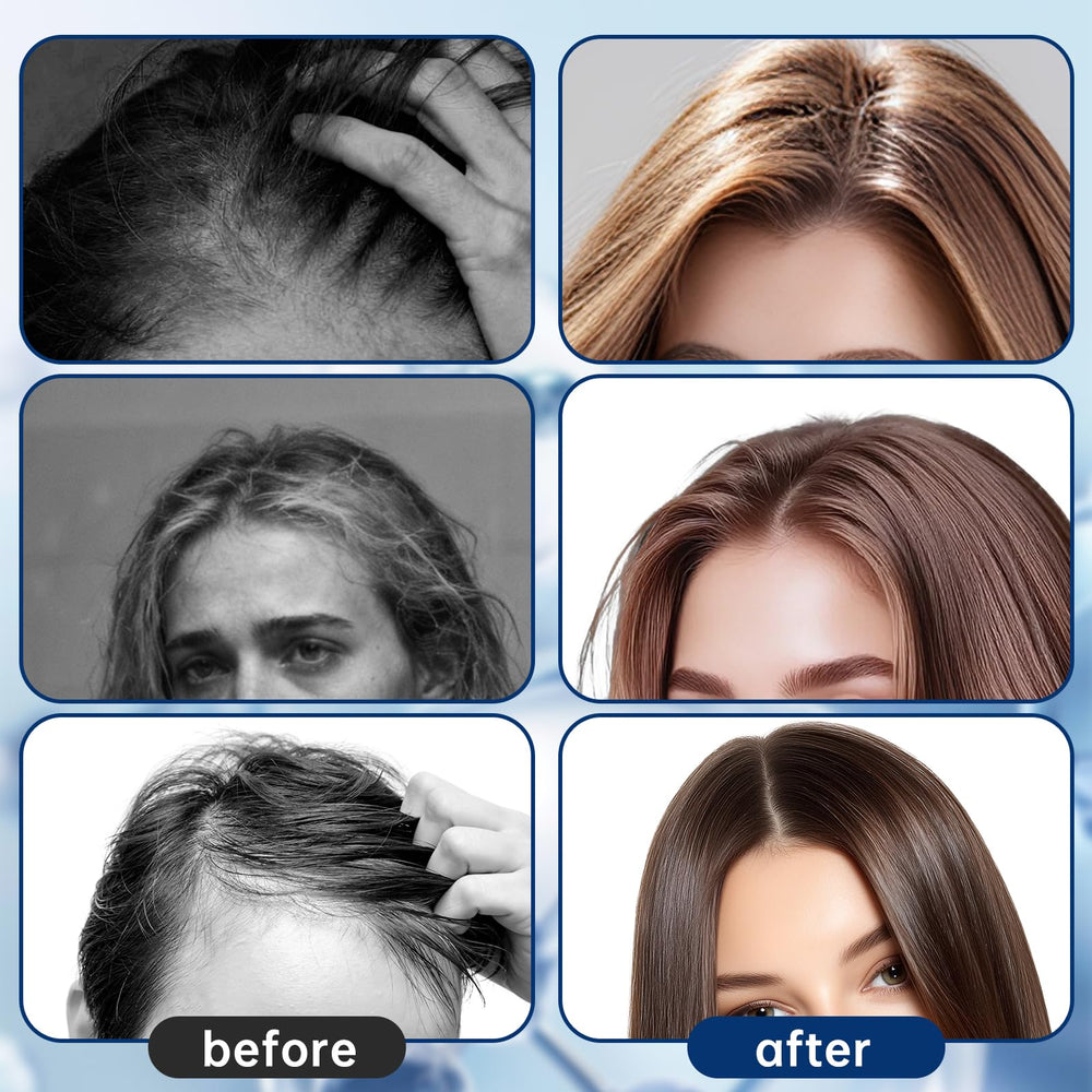 HASCURI precision roll-on targeting thinning areas during daily routine.