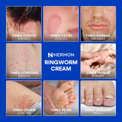 Hermon antifungal cleansing soap applied to feet exposes athlete's foot care use.