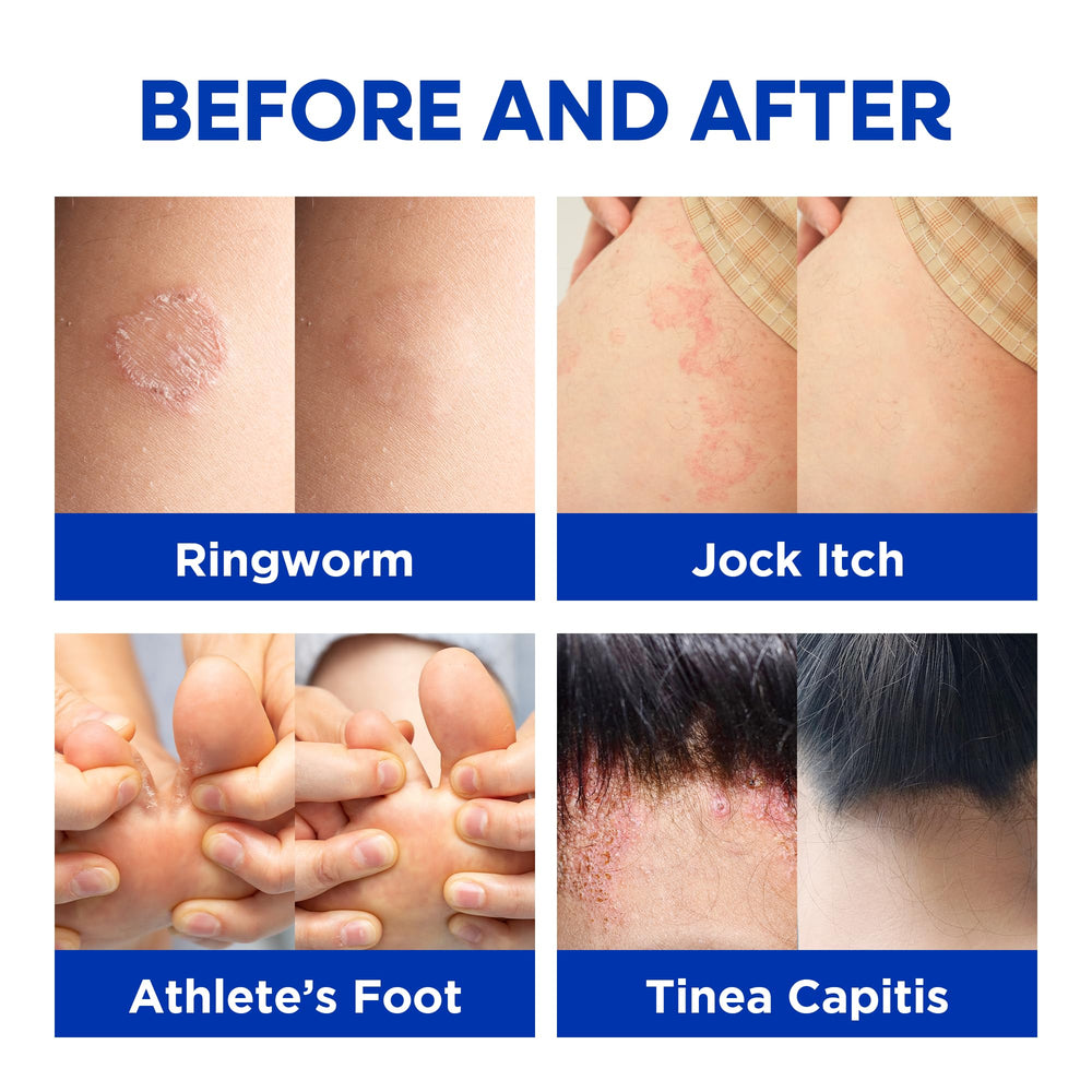 Hermon hands-and-body application demonstrates versatile skin cleansing routine.