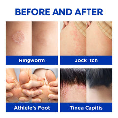Hermon hands-and-body application demonstrates versatile skin cleansing routine.