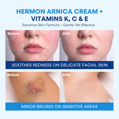 Hermon Arnica Bruise Cream swirl shows creamy consistency