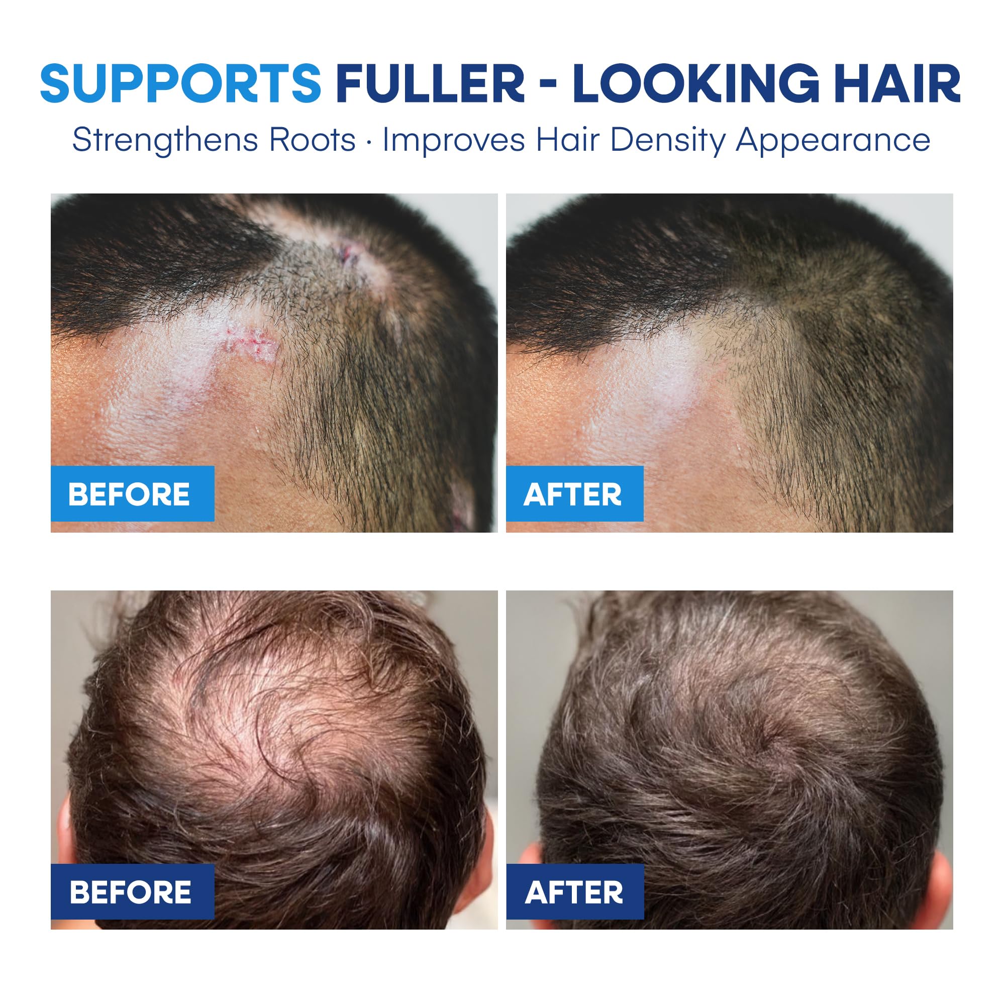 Hermon supports healthy hair follicles for fuller-looking strands.