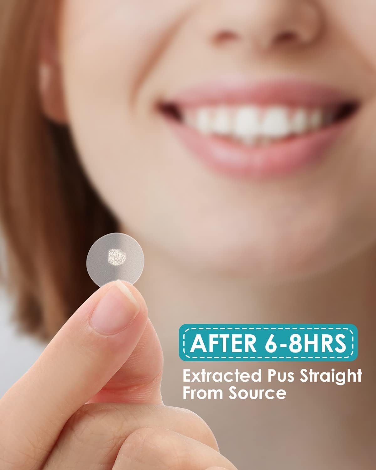 Hydrocolloid patch in two sizes covers whiteheads and light blemishes
