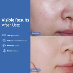 Hicream exfoliating pads dual-textured surface close-up