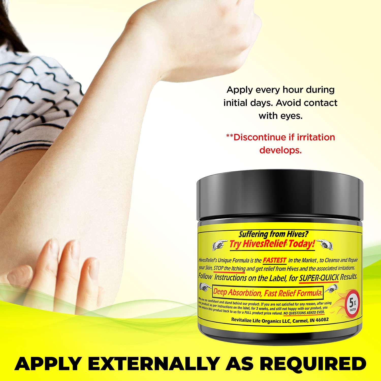 HivesRelief suitable for adults and kids with gentle care.