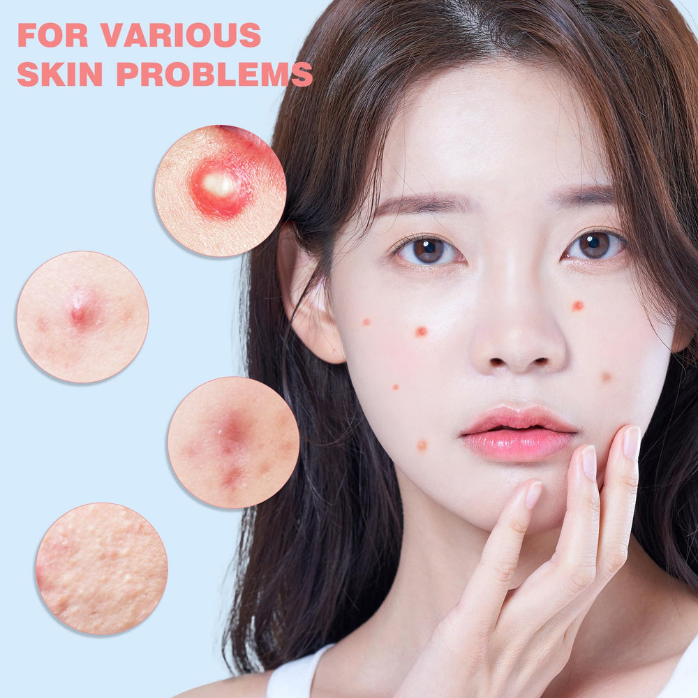 HLOES star patch medium applied to blemish for overnight wear