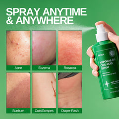 After-sun refresh with BIONA Pure spray reducing redness.