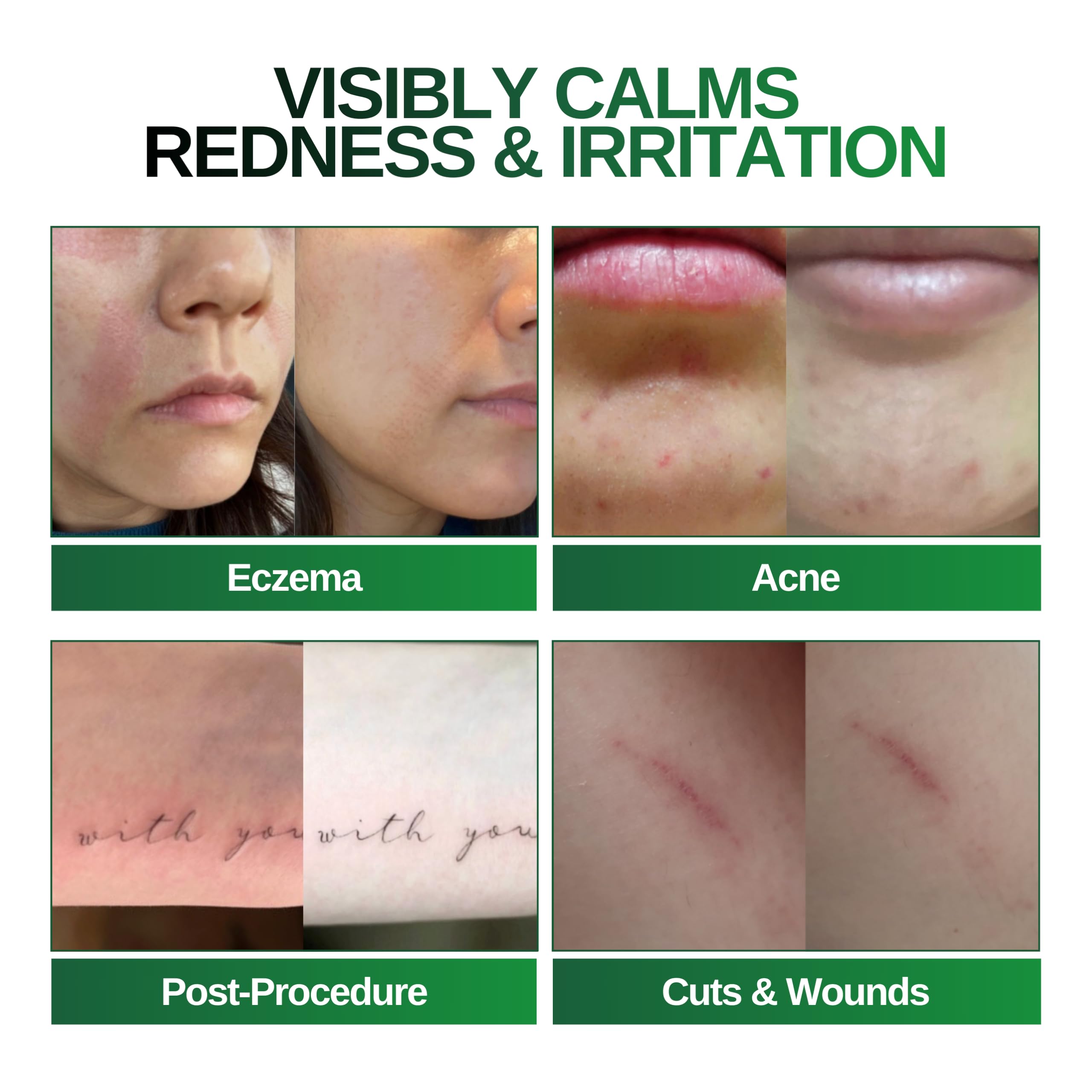 BIONA Pure mist on face demonstrating soothing, cooling application.