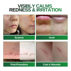 BIONA Pure mist on face demonstrating soothing, cooling application.