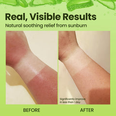 Honeyskin Organic Aloe Vera Gel featuring orchid and apple stem cells.
