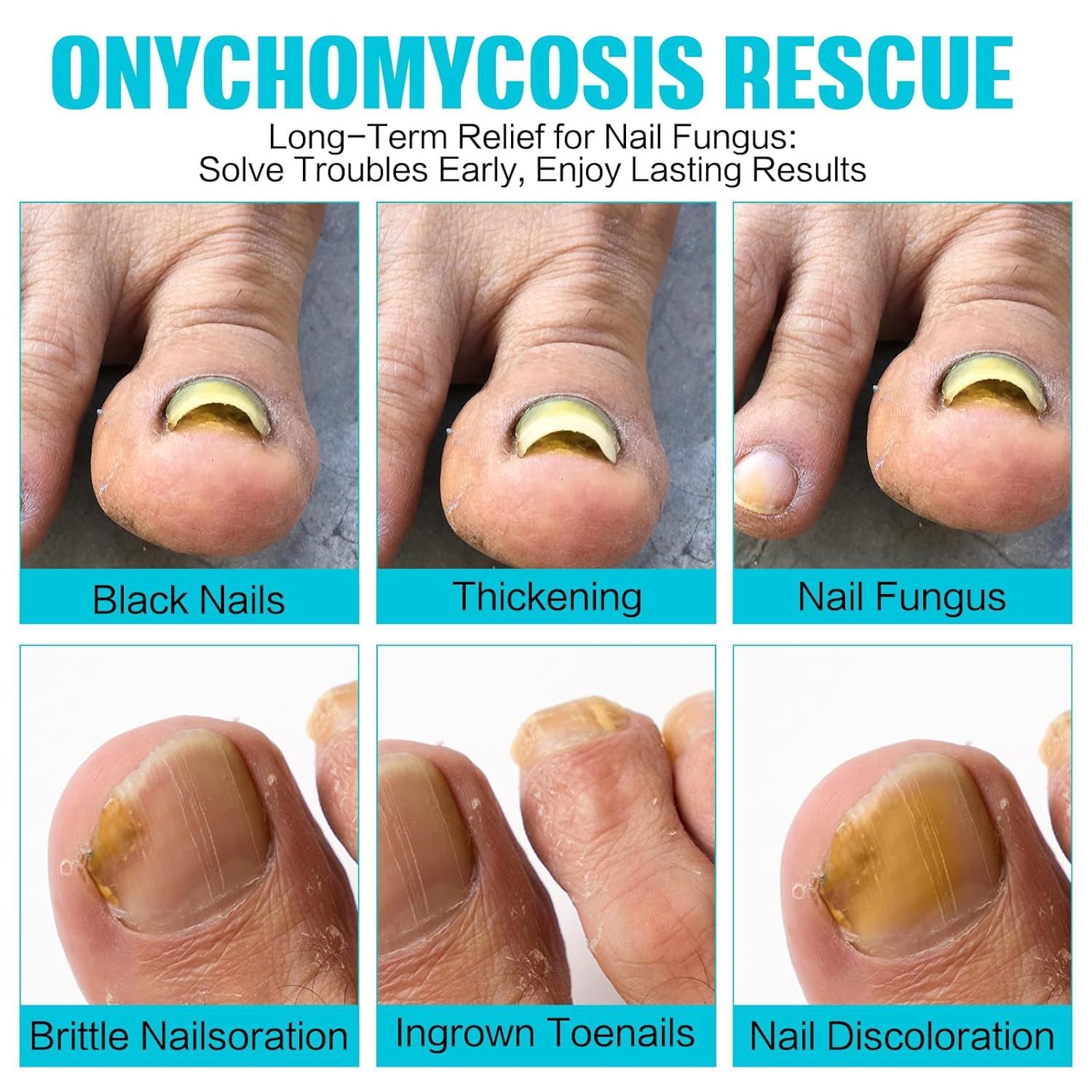 HQCC 21-piece nail care patches set for daily use on fingers and toes