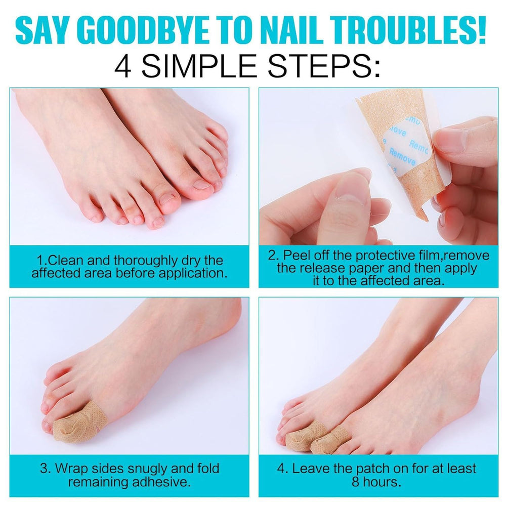 HQCC fungal nail patch on toenail for comfortable all-day wear