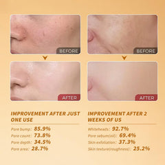 HUiPENGFEI layering-friendly exfoliant ampoule for seamless makeup and actives use.
