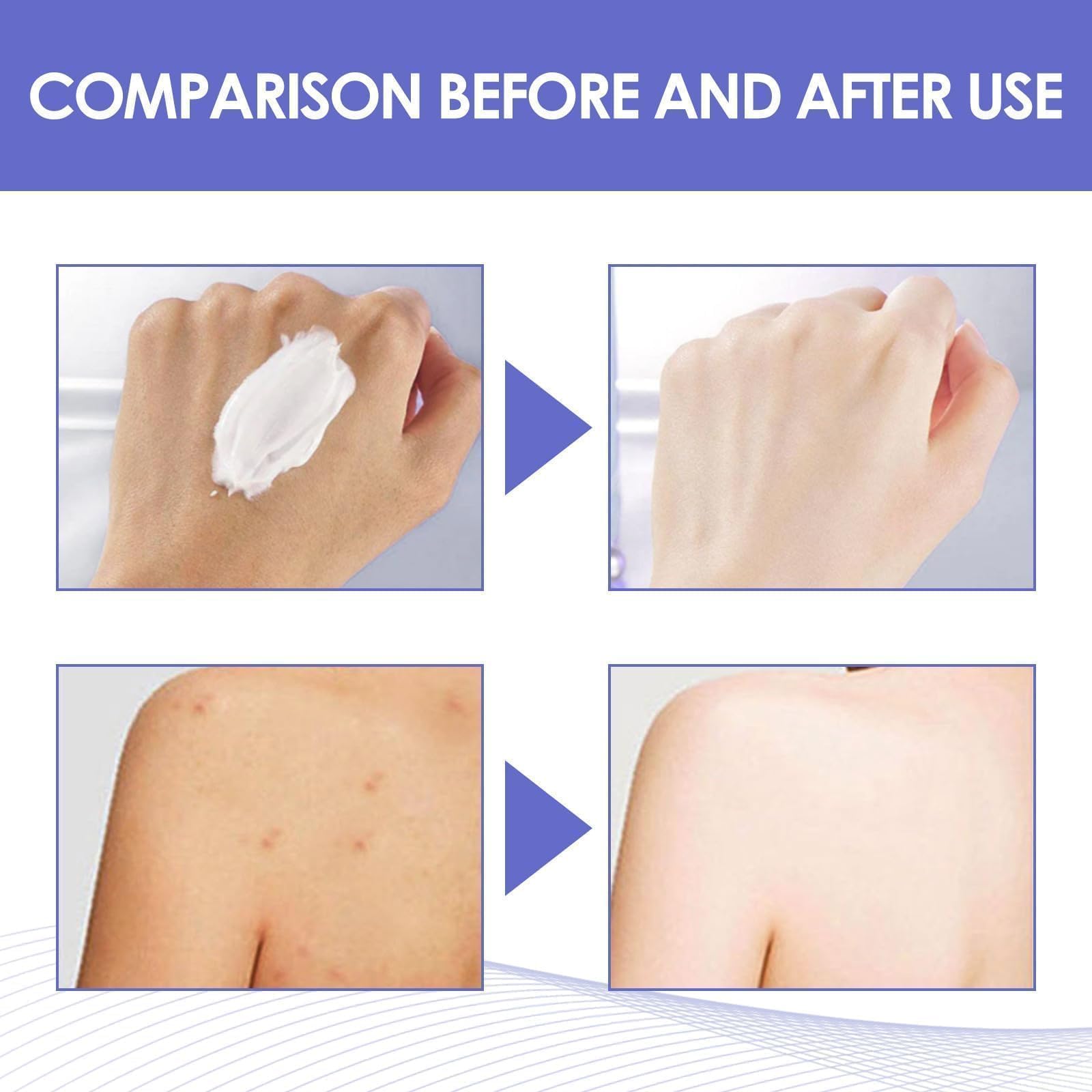 Skin looks softer and hydrated after using Intimate Area Brightening Cream
