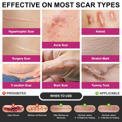 Hysimedy hypoallergenic silicone scar tape on skin for sensitive use