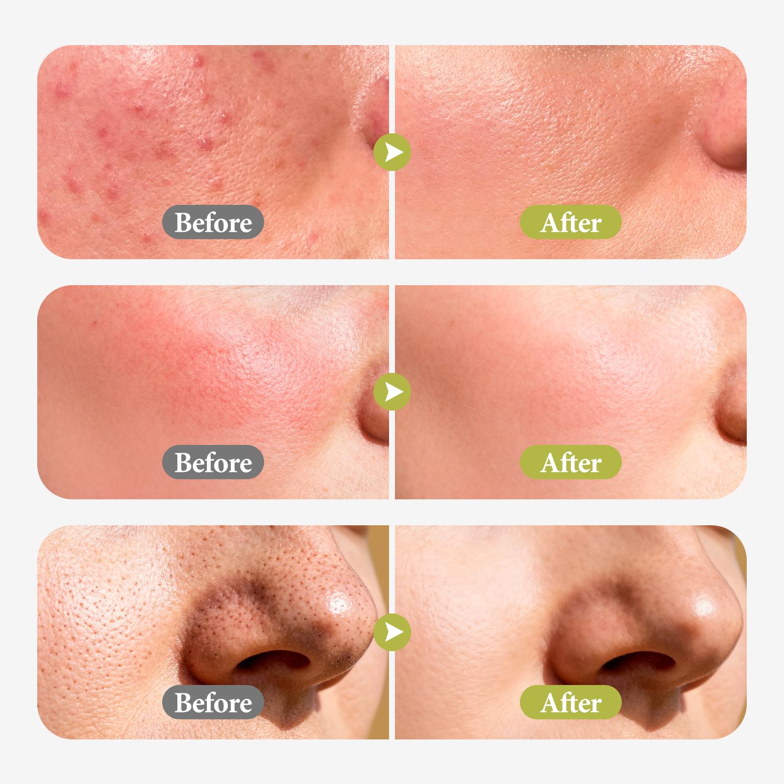 Hyuxeo close-up texture image suggests gentle exfoliation and renewal.