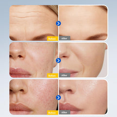 Hyuxeo Hydrolyzed collagen serum close-up emphasizing a smooth look.