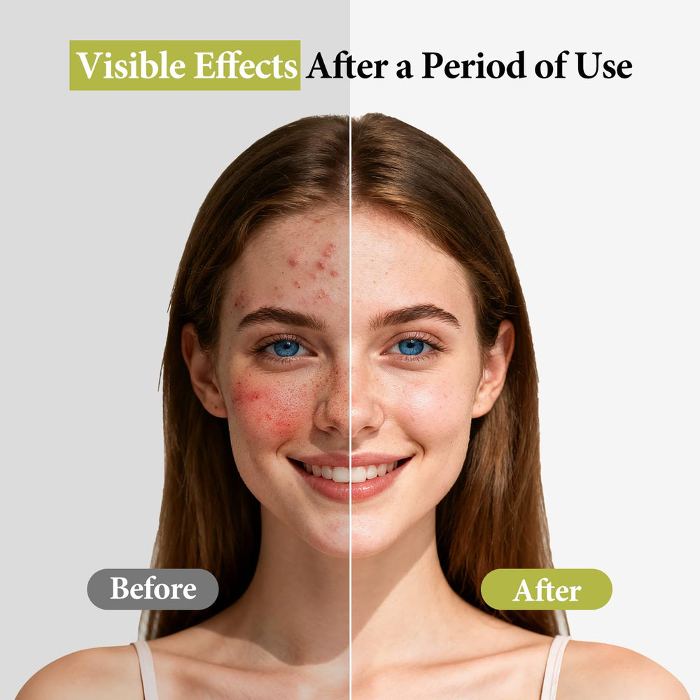 Hyuxeo witch hazel infusion provides soothing comfort during use.