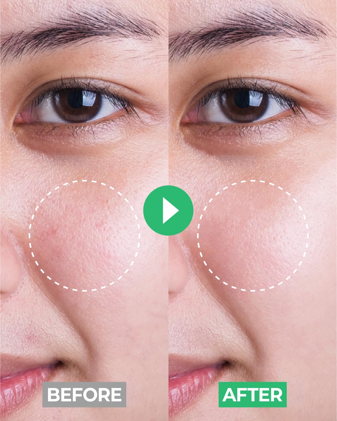iBodle gentle cleanser for delicate young skin.