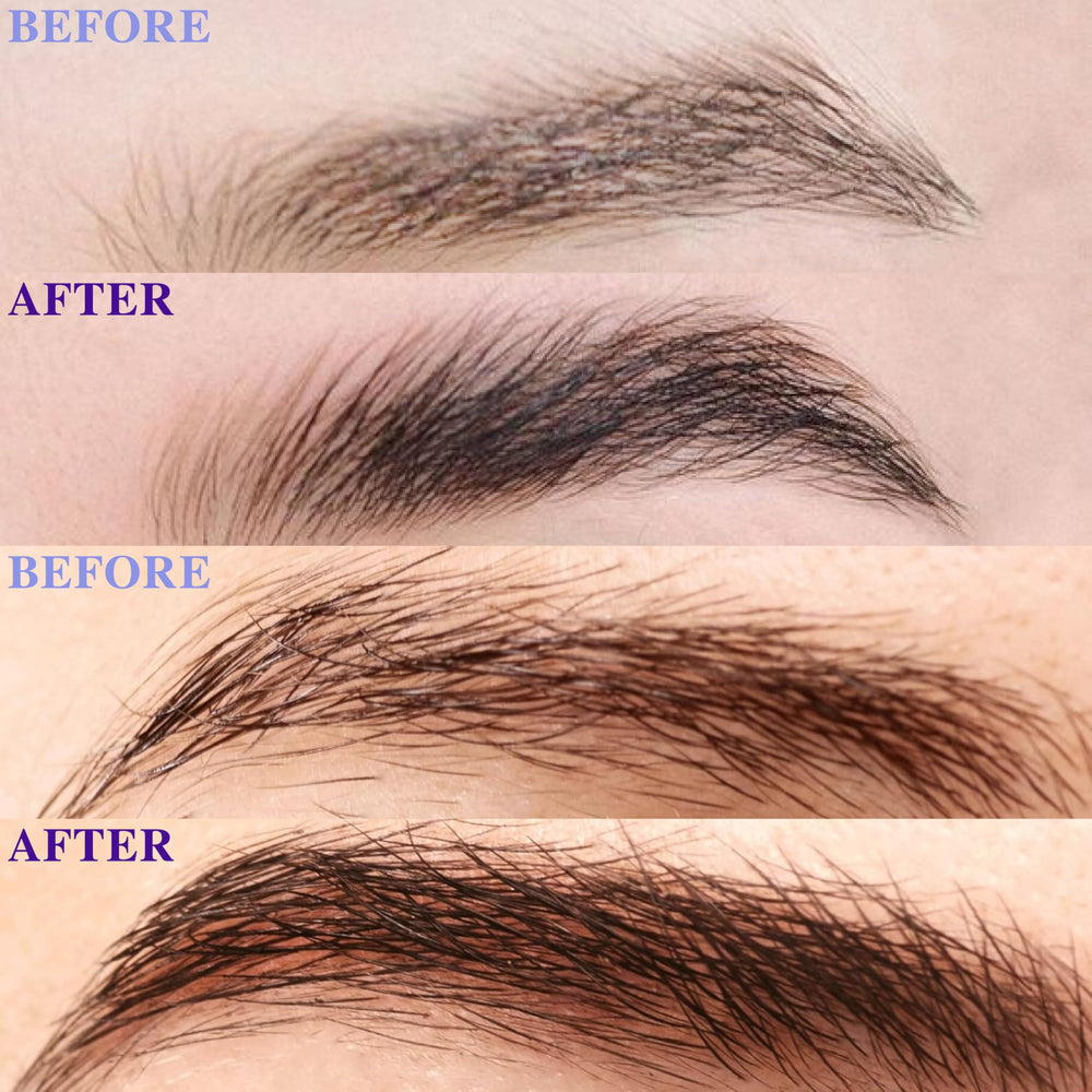 Before-after brow comparison featuring ICIKOL growth serum results.
