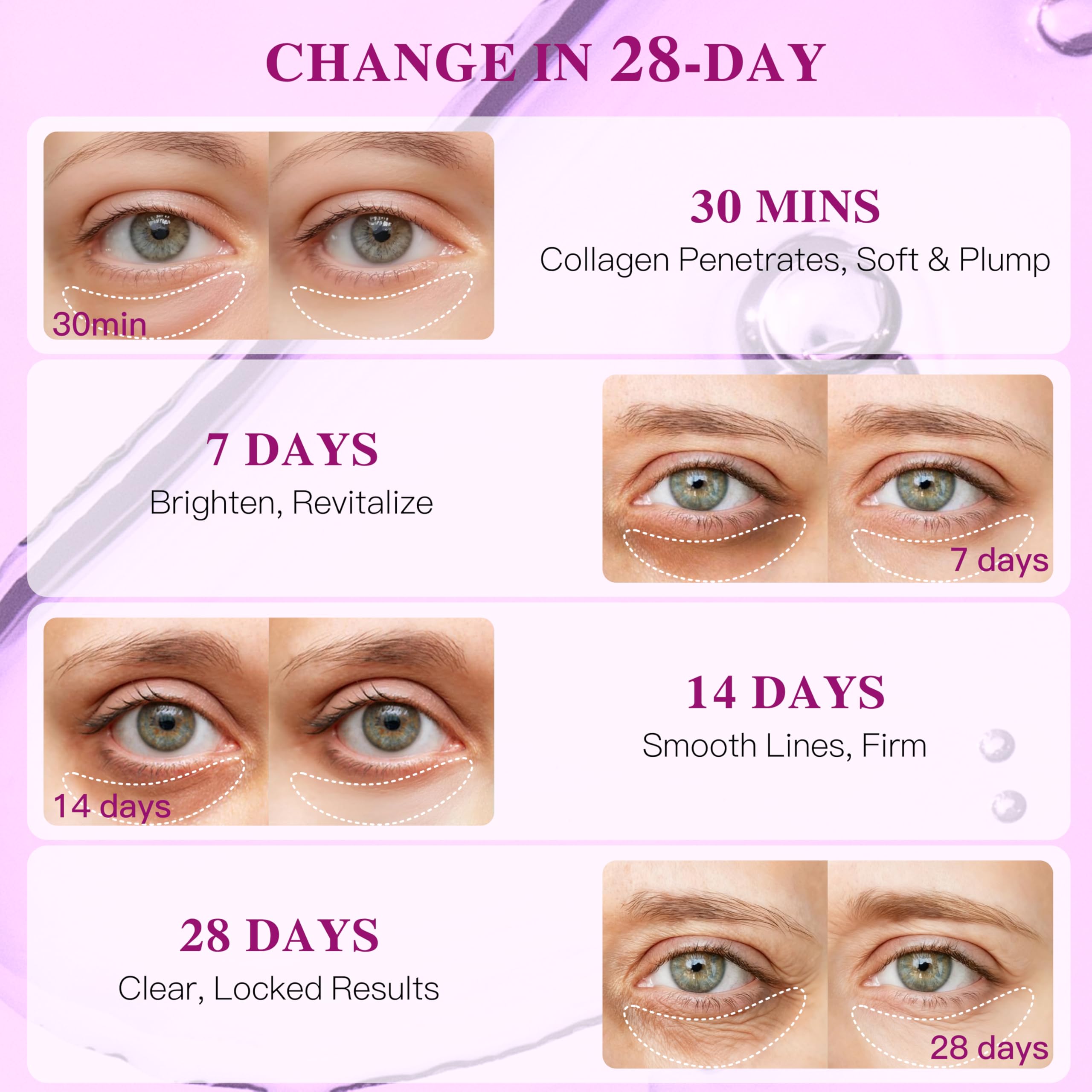 ICIKOL gentle formulation under-eye patches suitable for sensitive skin.