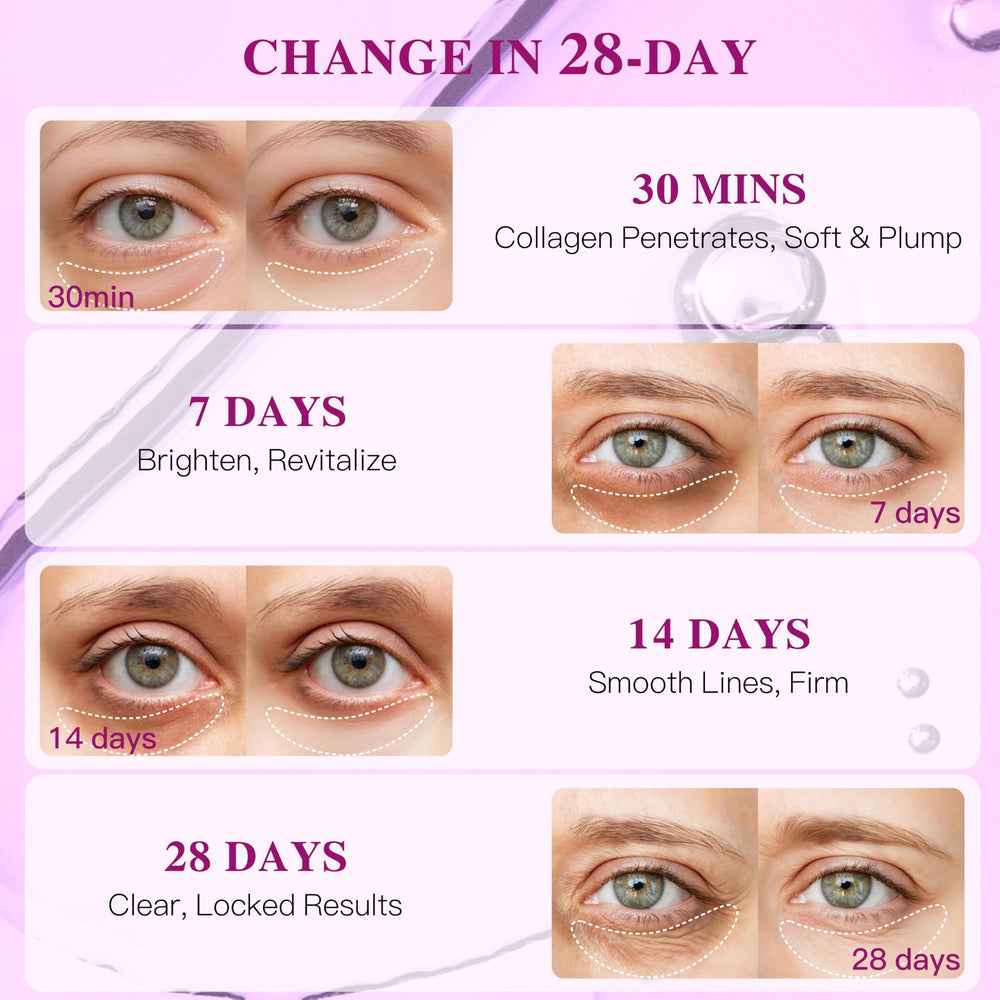 ICIKOL gentle formulation under-eye patches suitable for sensitive skin.