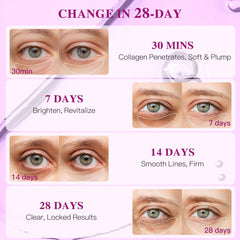 ICIKOL gentle formulation under-eye patches suitable for sensitive skin.
