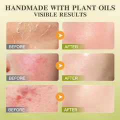ICIKOL balm ready for full body care and daily moisturization