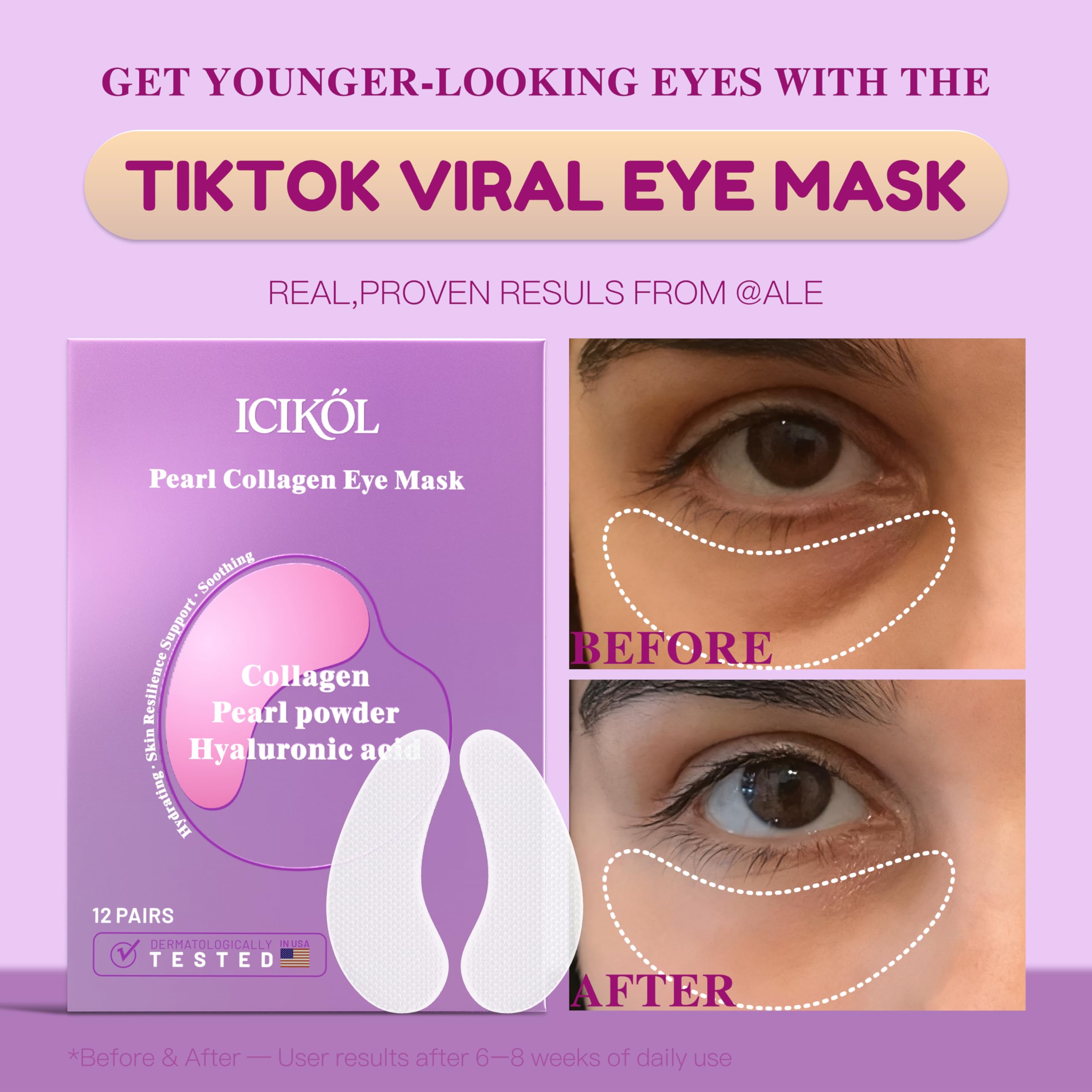 ICIKOL under eye patches close-up applying formula for smoother skin.