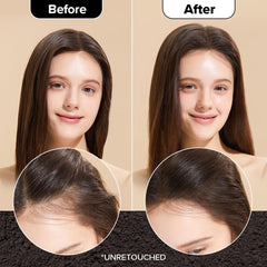 I DEW CARE Travel size dry shampoo compact for on-the-go refresh