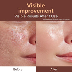 ID PLACOSMETICS Exo-V Booster ampoule with dropper supports quick absorption in morning routine.