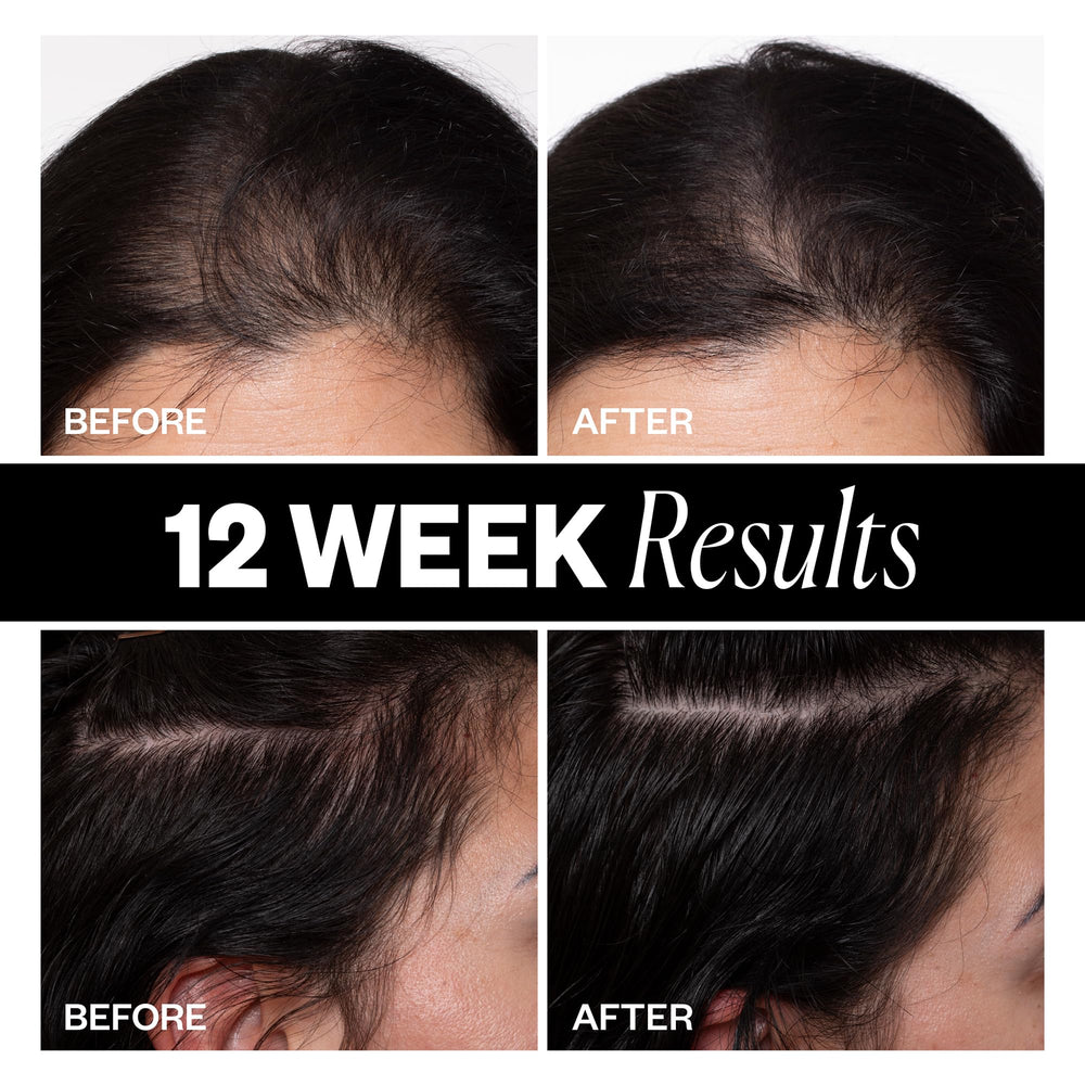 IGK biotin-focused image emphasizes stronger, healthier-looking hair support