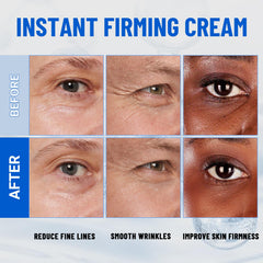 iMethod Perfection Eye Tightener in-use on dry skin reducing dryness lines