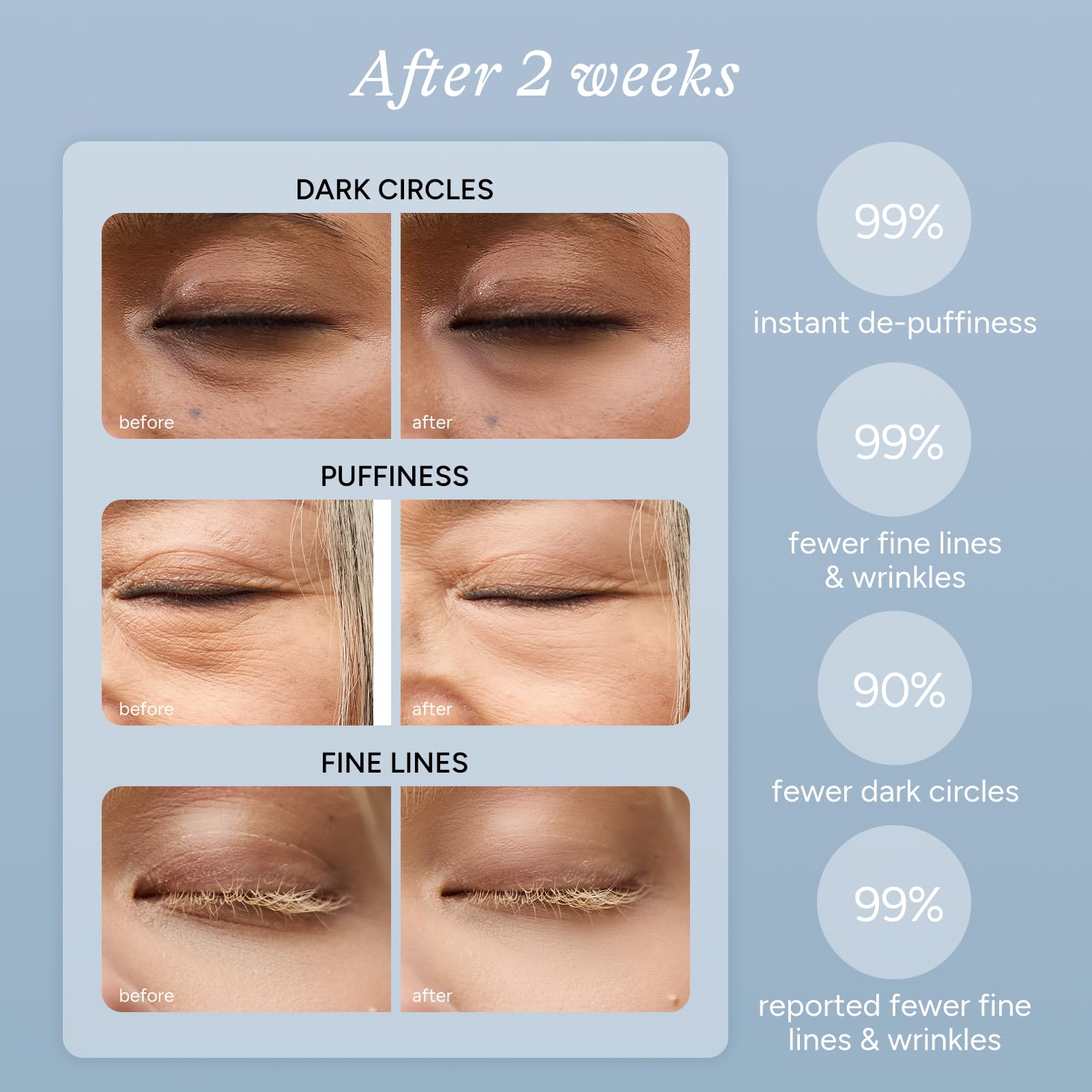 In My Eyes upper-lids focus patches reduce puffiness for a more awake appearance.