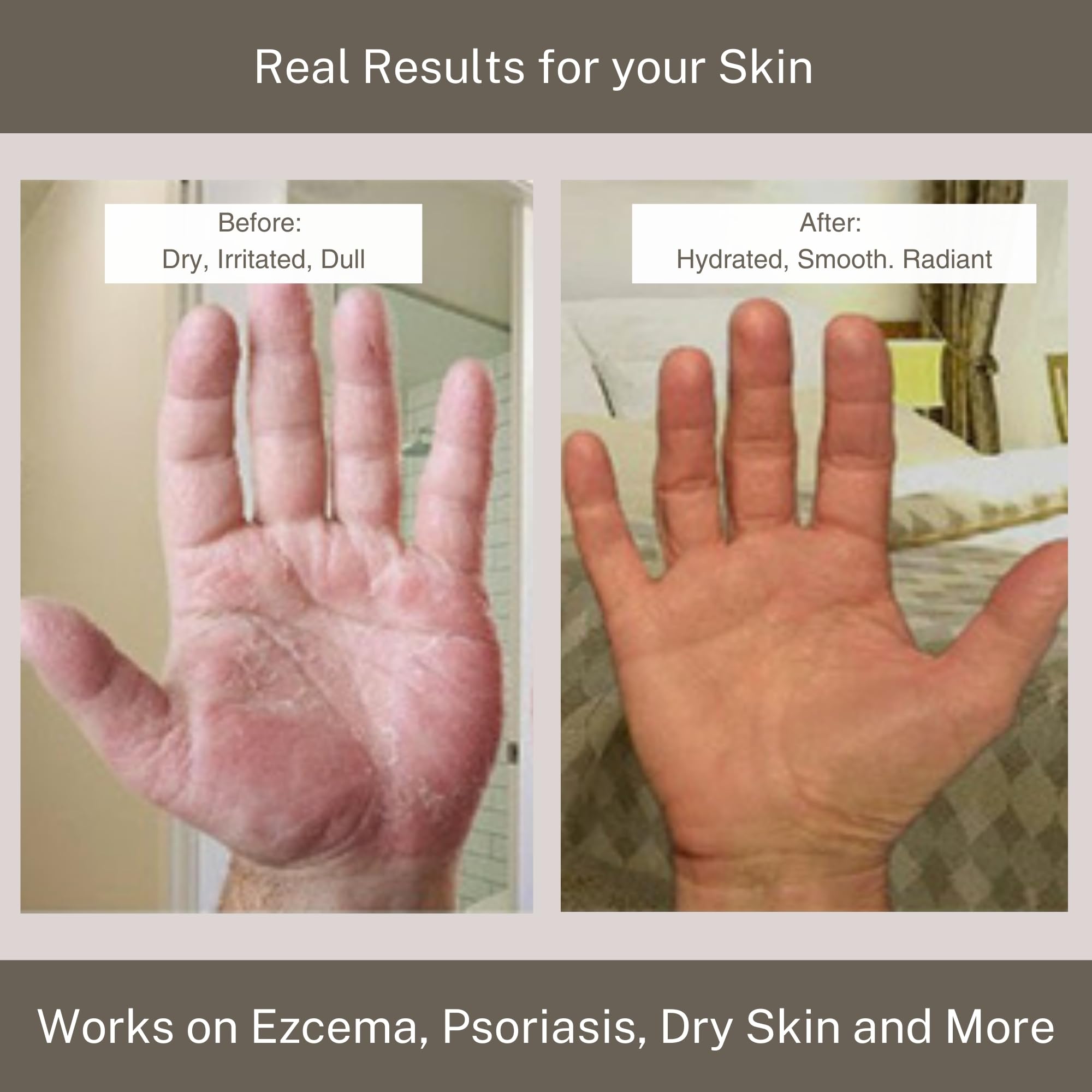 Daily-use moisturizer for dry skin across all skin types.