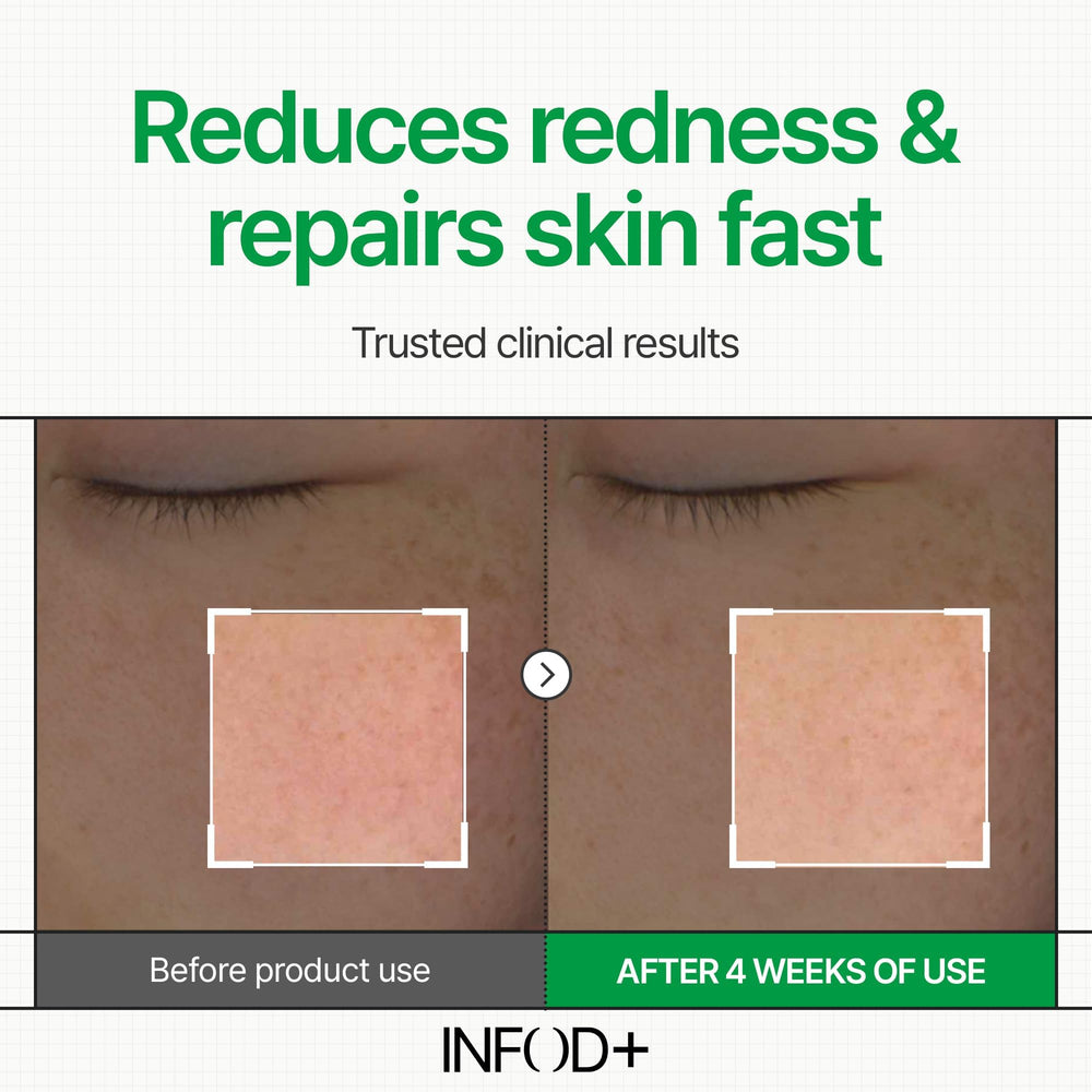 InfodPlus low-pH daily moisturizer packaging signals gentle, everyday care.