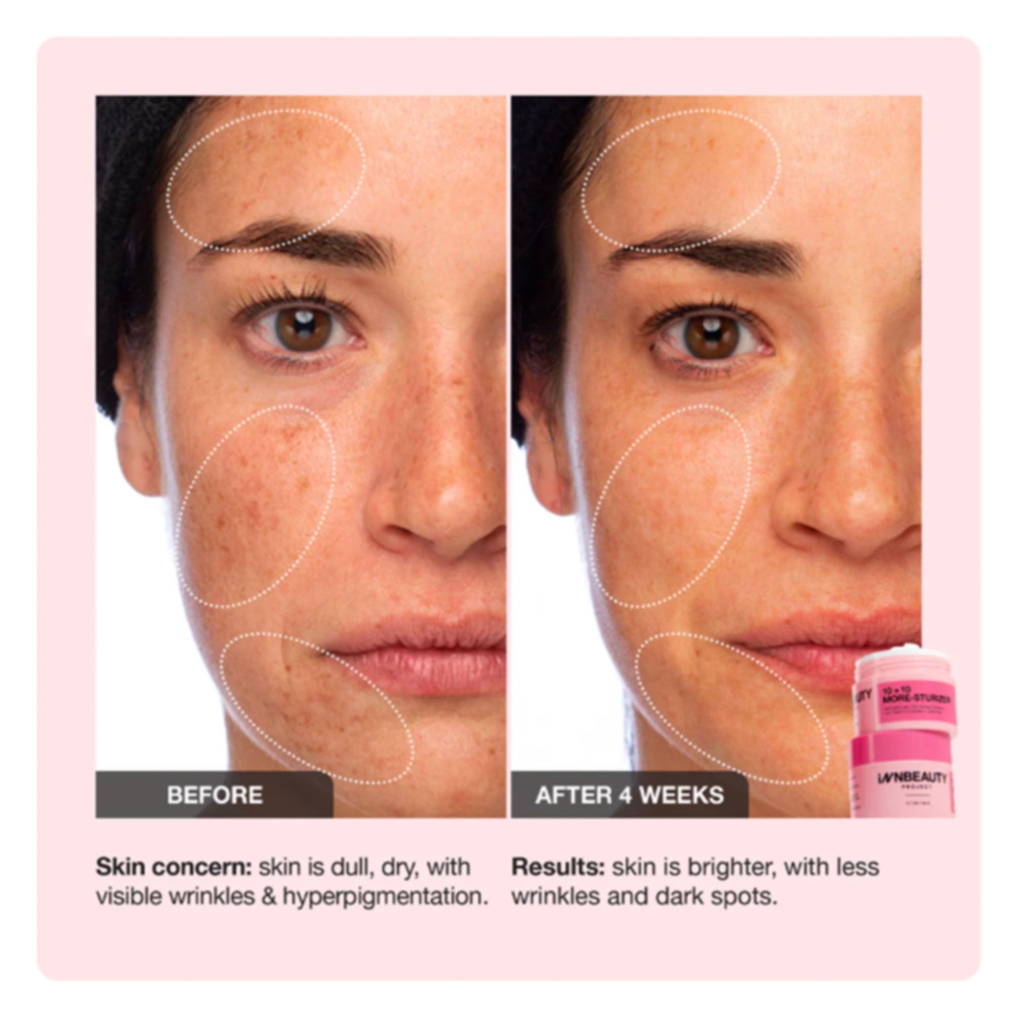 Innbeauty Project 10+10 vitamin C icon hints brightening potential and antioxidant support.