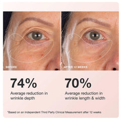 Innbeauty Project Extreme Cream Eye Firming ingredients peptides botanicals highlighting targeted anti-puffiness and contour support