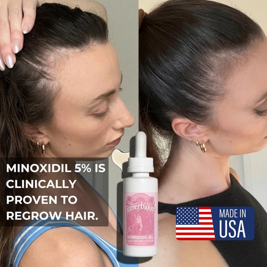 Innerbloom Minoxidil dropper shown for precise thinning-area application.