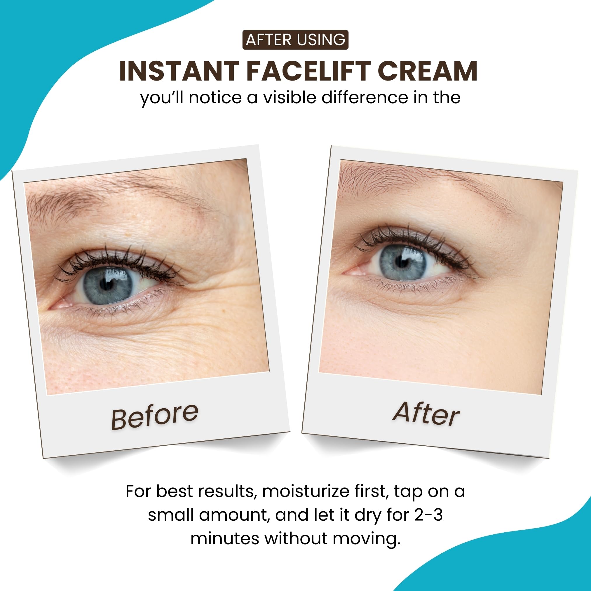 Instantly Ageless wrinkle reducer tightening facial skin for a refreshed look.