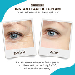 Instantly Ageless wrinkle reducer tightening facial skin for a refreshed look.