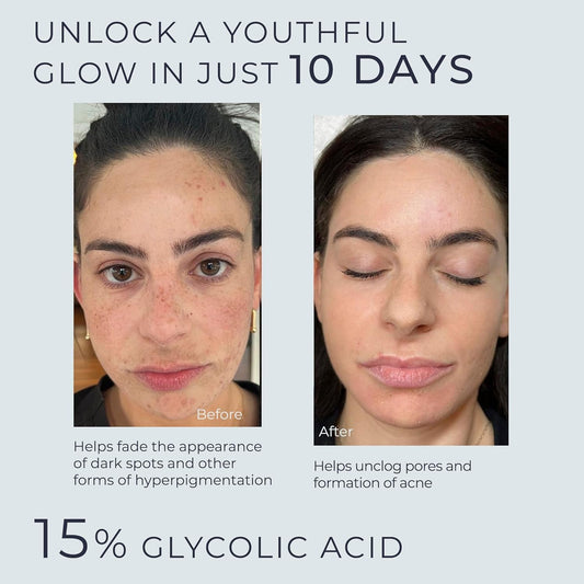 InstaSkincare Glycolic Serum 15% pump bottle enables easy daily application.