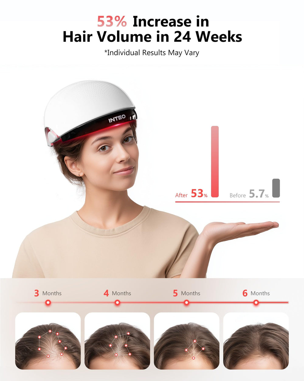 INTEO laser light matrix coverage showing even scalp stimulation