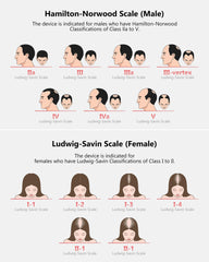 INTEO remote control start/stop for convenient sessions