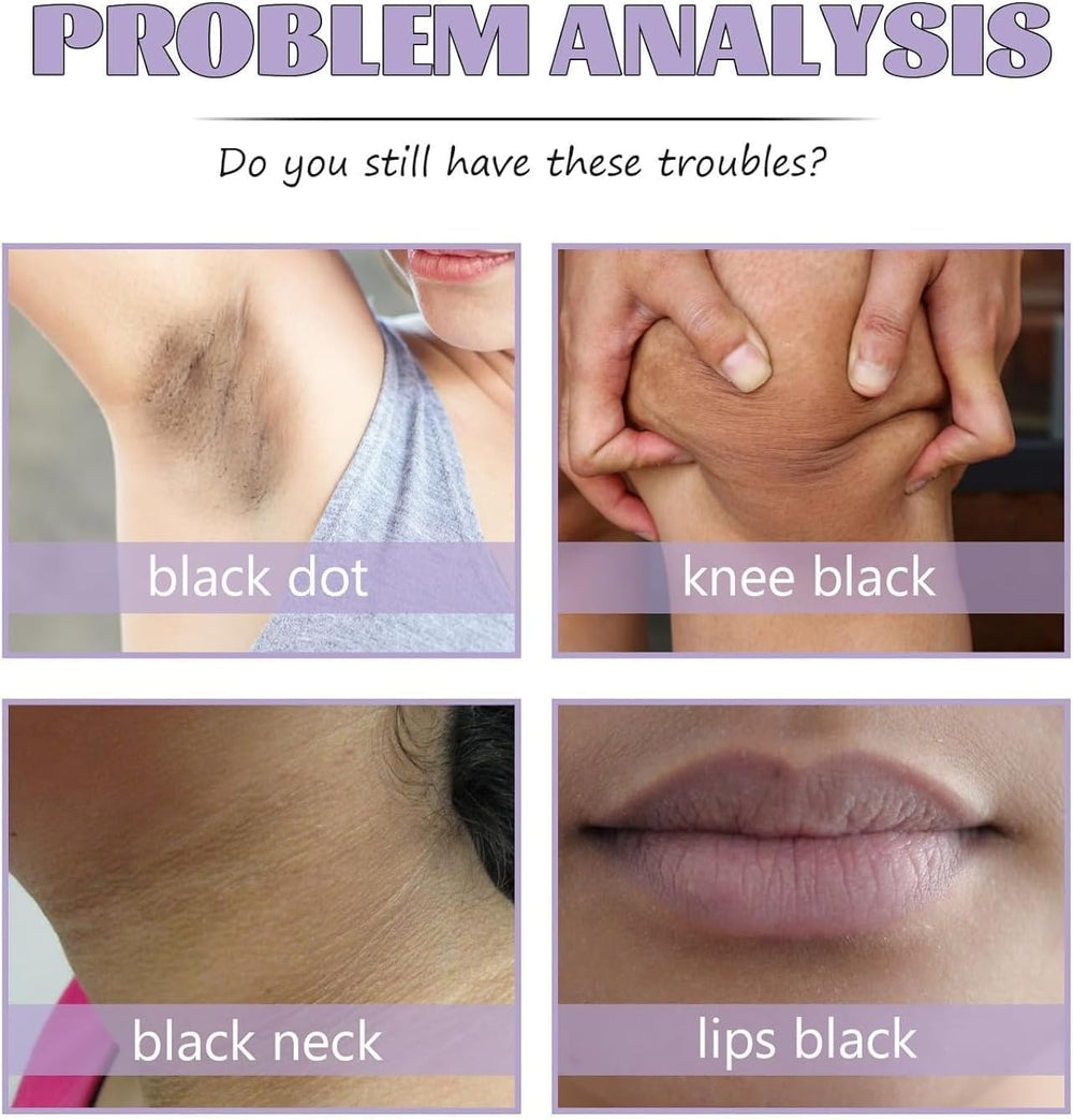 Intimate Lightening Cream inner thighs improves tone in sensitive areas.